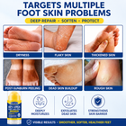 DermaPure urea foot stick for dry feet, flaky skin, dead skin buildup, rough and thickened foot skin